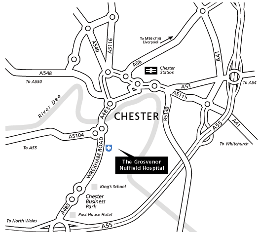 Map showing location of Chester Knee Clinic